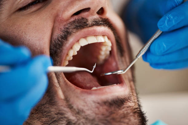 Best Emergency Treatment for Oral Infections in St Paul Park, MN